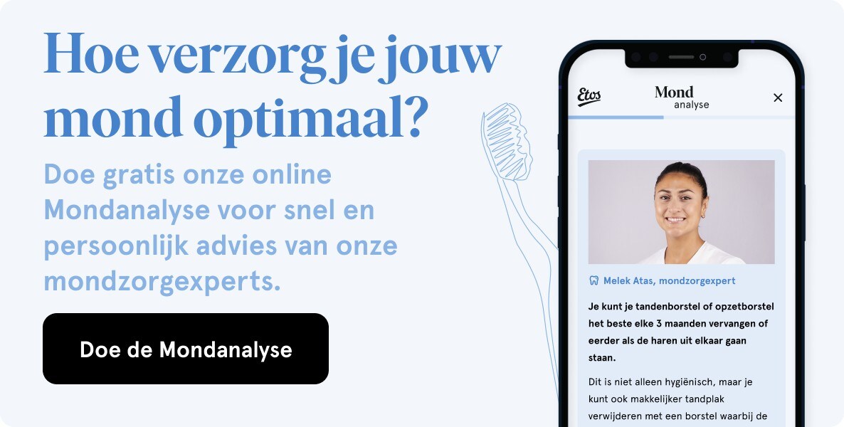 Mondanalyse